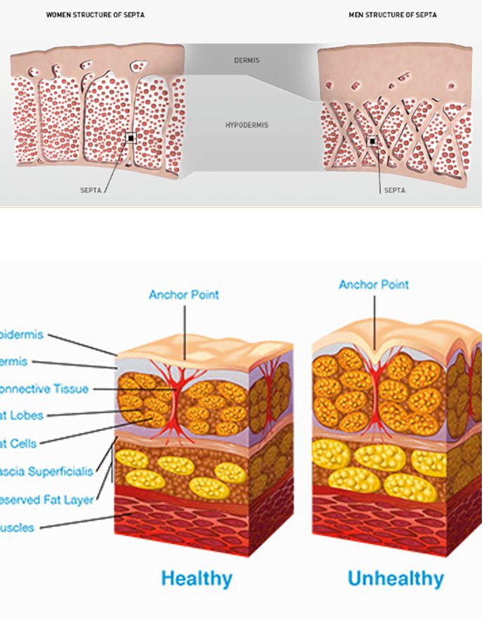 STRUKTURA VEZIVNOG TKIVA I VAZNOST SEPTE - Celulit Ekspert - Lider u estetskoj i fizikalnoj terapiji