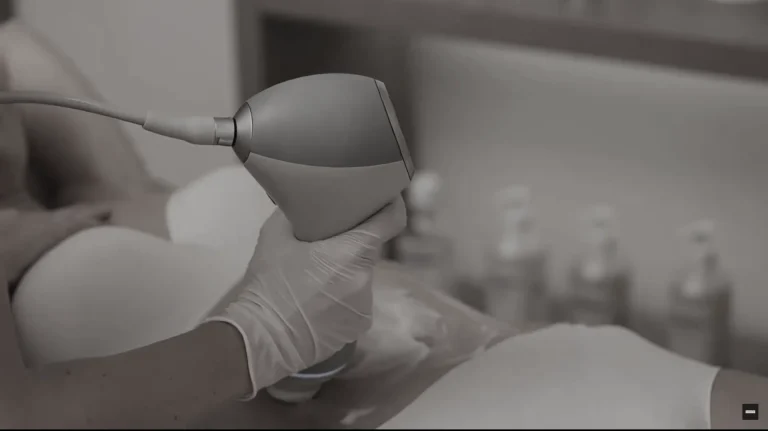 EMTONE v1 - Celulit Ekspert - Lider u estetskoj i fizikalnoj terapiji