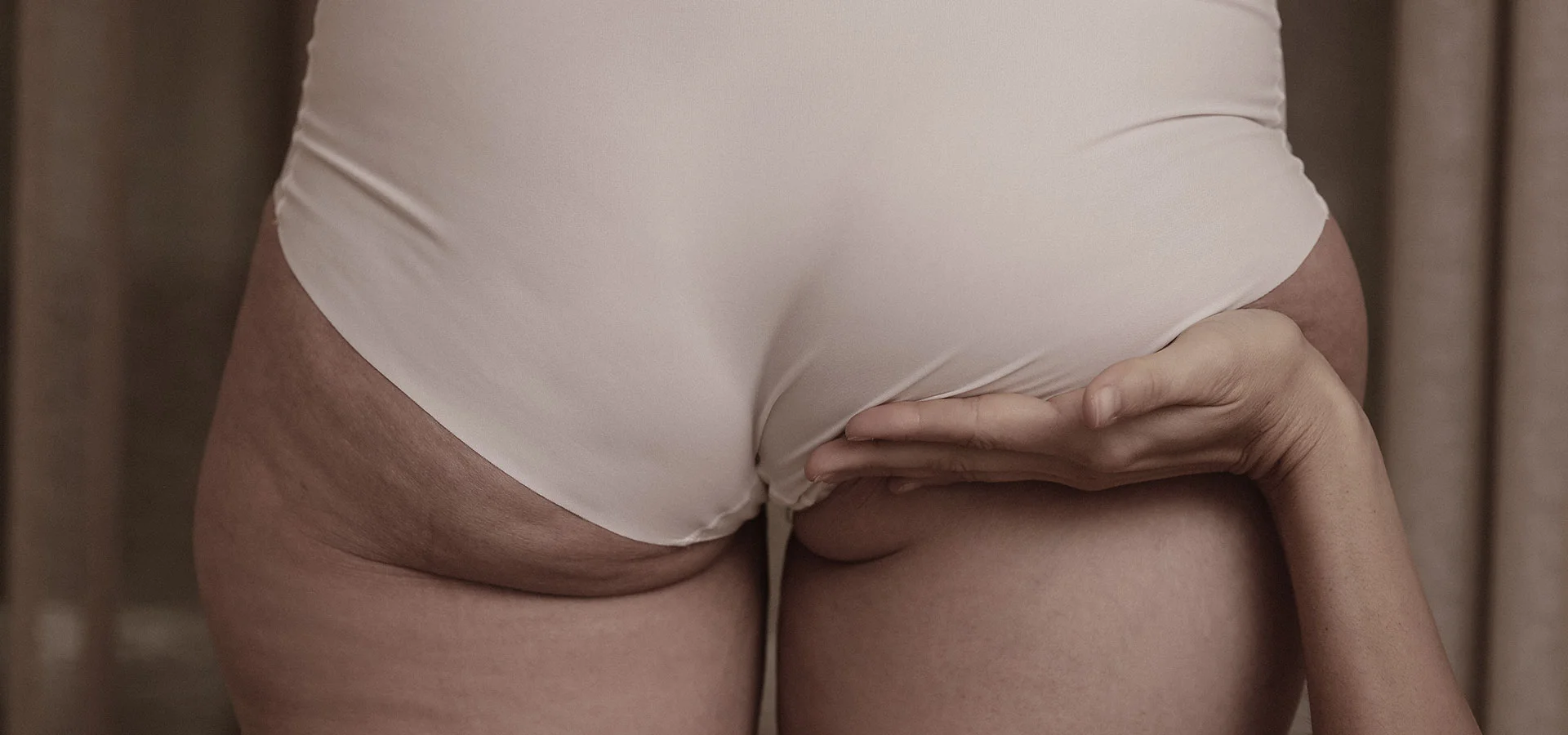 Slab tonus stomaka i gluteusa 1 Slab tonus stomaka i gluteusa - Celulit Ekspert - Lider u estetskoj i fizikalnoj terapiji